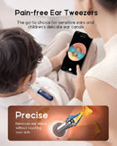 Smart Ear Wax Remover – 1080p Camera for Safe Cleaning